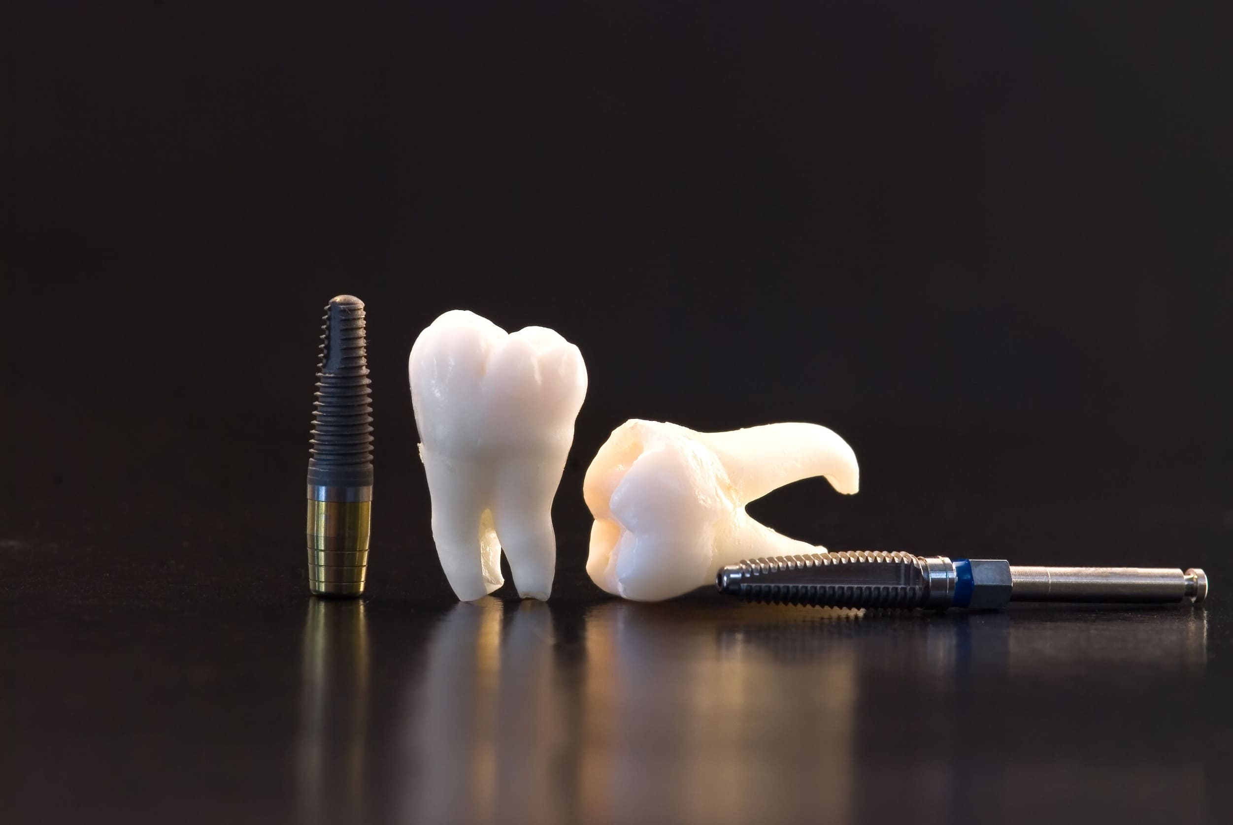 Dental implants and All-on-4 at Dentelli Split – leading implant dentist in Split for full-arch tooth replacement solutions