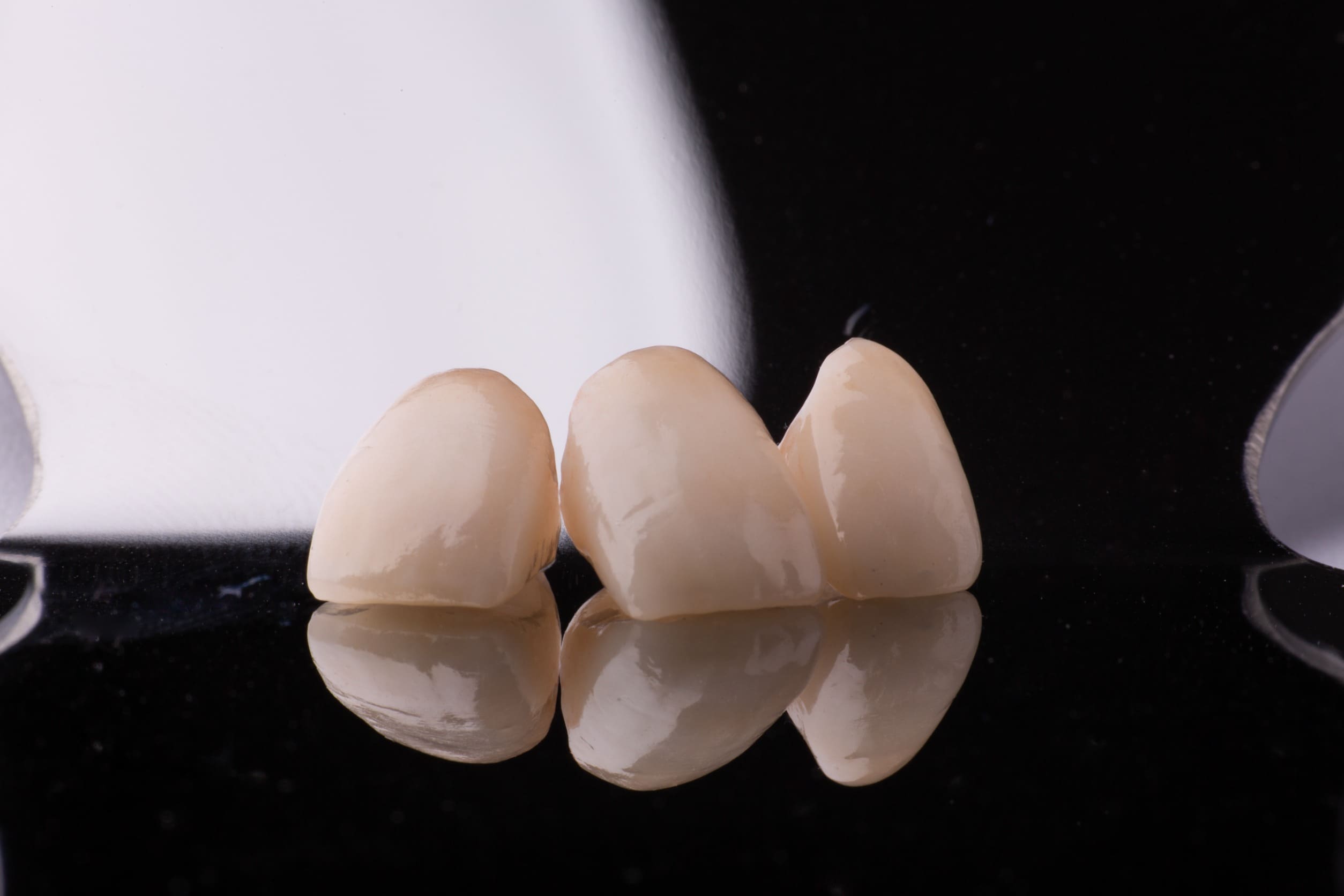Dental crowns and bridges at Dentelli Split – trusted dentists in Split offering restorative treatments for damaged or missing teeth